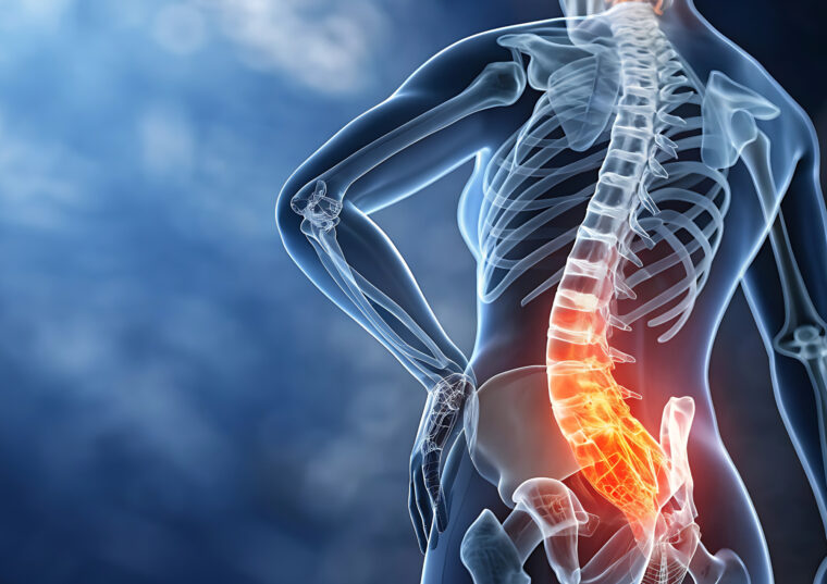 レントゲンで異常なしと言われた腰痛…原因は一体どこにある？